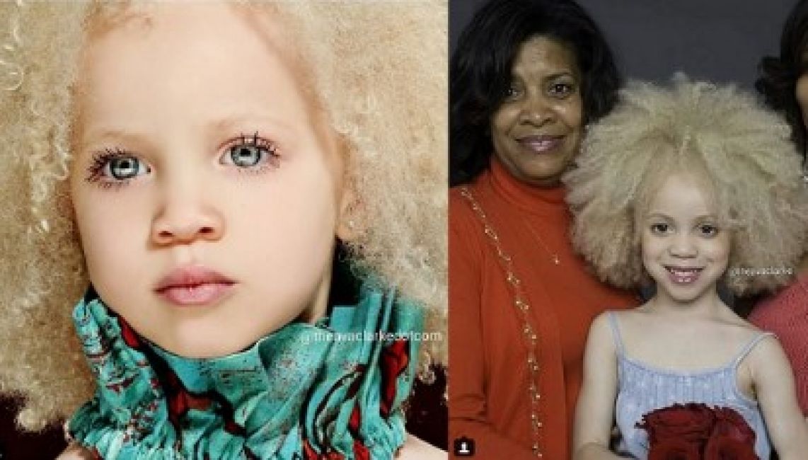 Esta nena albina de raza negra hizo estallar las redes sociales - Que Pasa  Salta