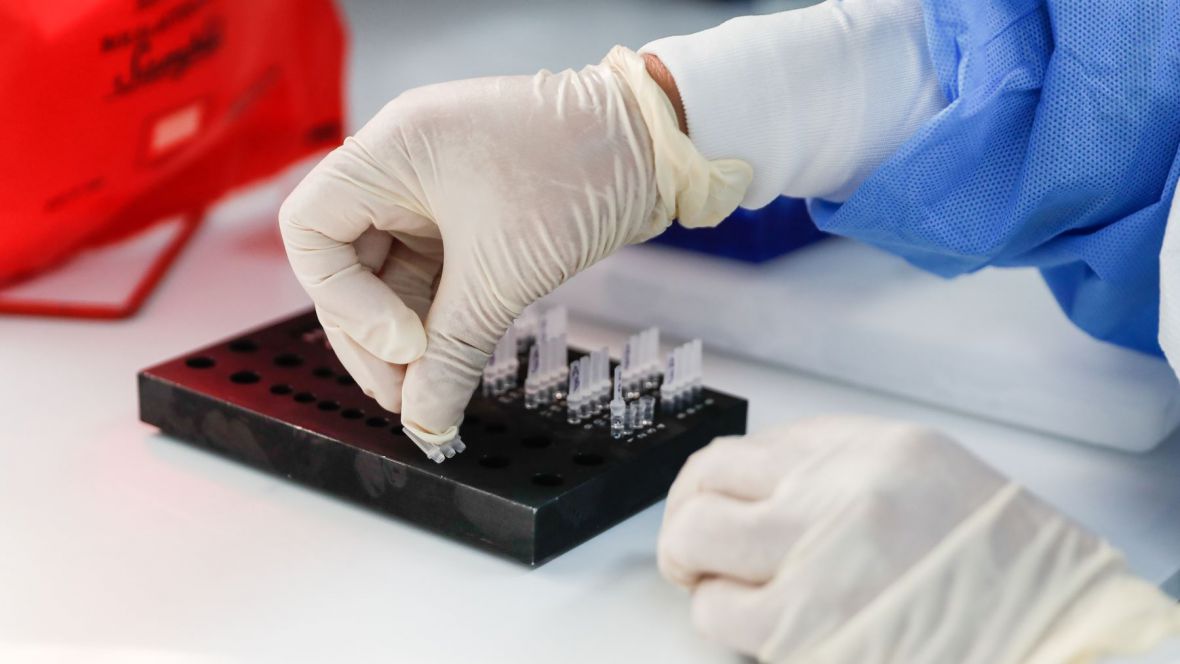Salta sería una de las primeras provincias donde harán el test para detectar coronavirus