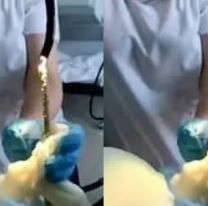 [VIDEO] Le dolía el cuerpo y fue al hospital: una víbora se le metió adentro