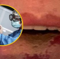 "Te destroza la lengua": médico alertó lo que puede pasarle a miles en Salta